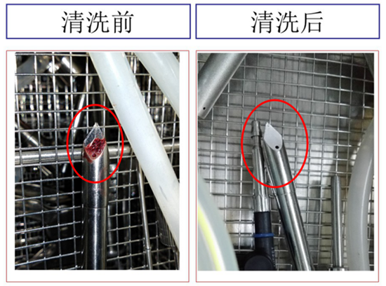 醫療植入器械的深層精密清洗解決方案